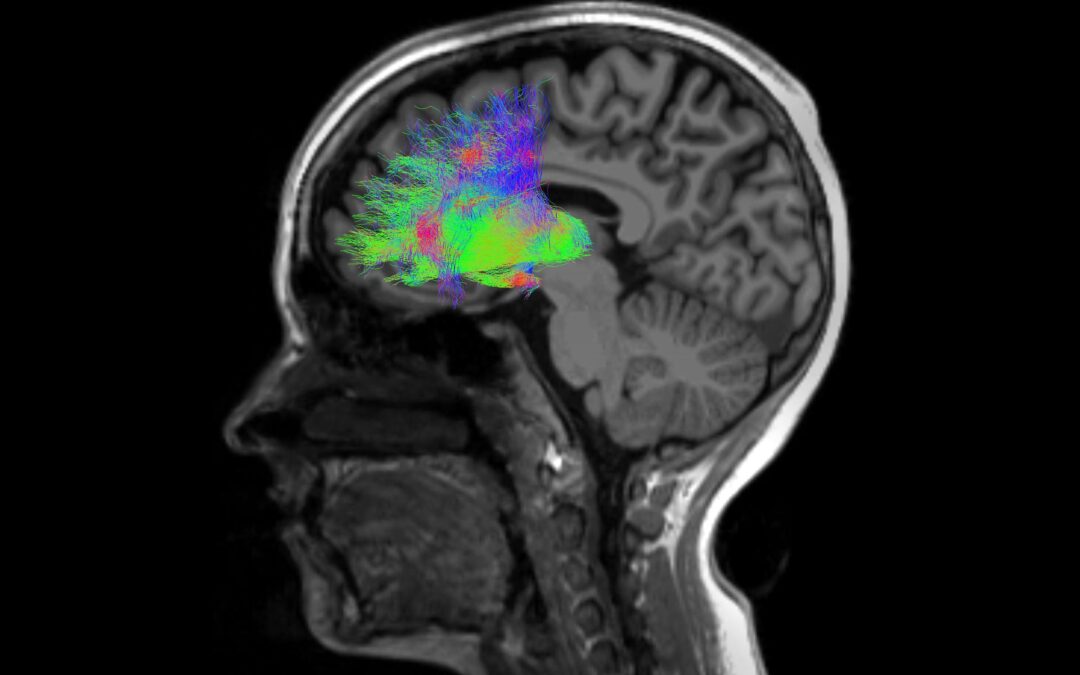 Paper Alert! Revealing the Neural Basis of Executive Dysfunction in Schizophrenia