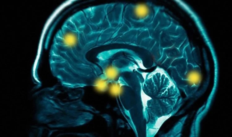 GABAergic Targeting in Psychotic Disorders: A Forgotten Piece of the Puzzle?