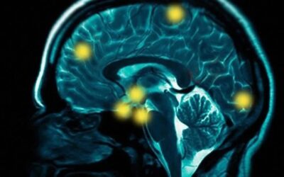 GABAergic Targeting in Psychotic Disorders: A Forgotten Piece of the Puzzle?